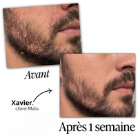 Malo Sérum Régulateur