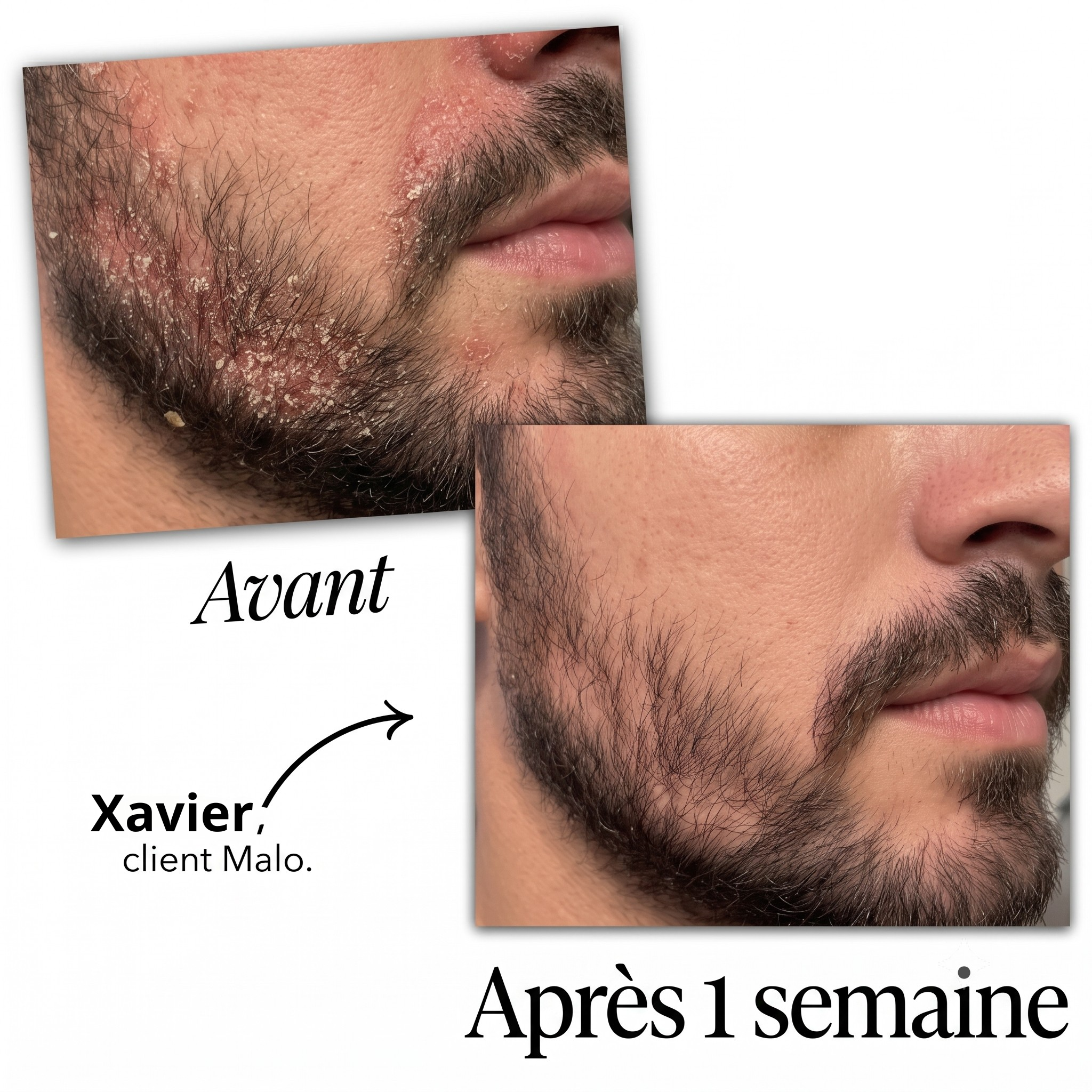 Malo Sérum Régulateur