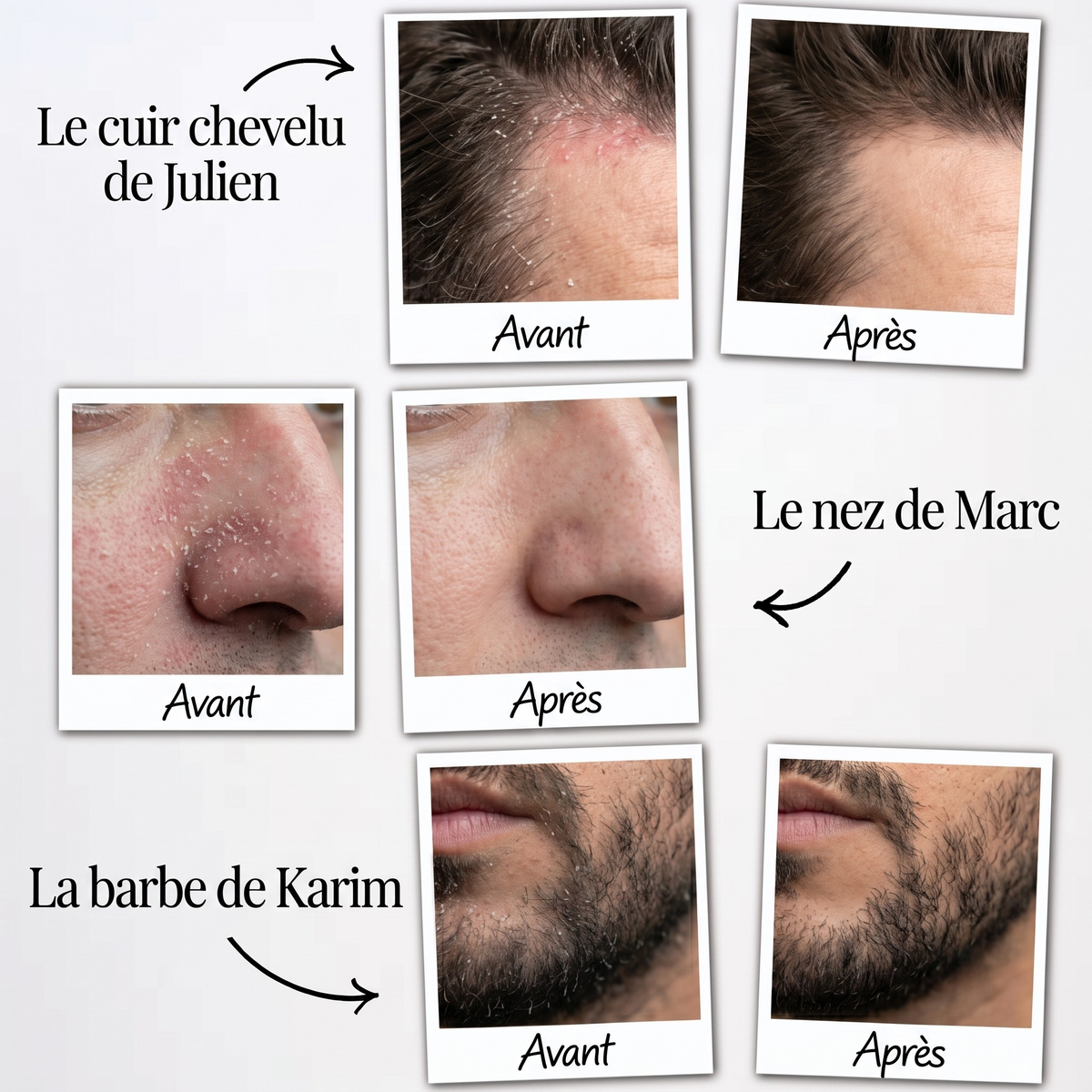Malo Sérum Régulateur