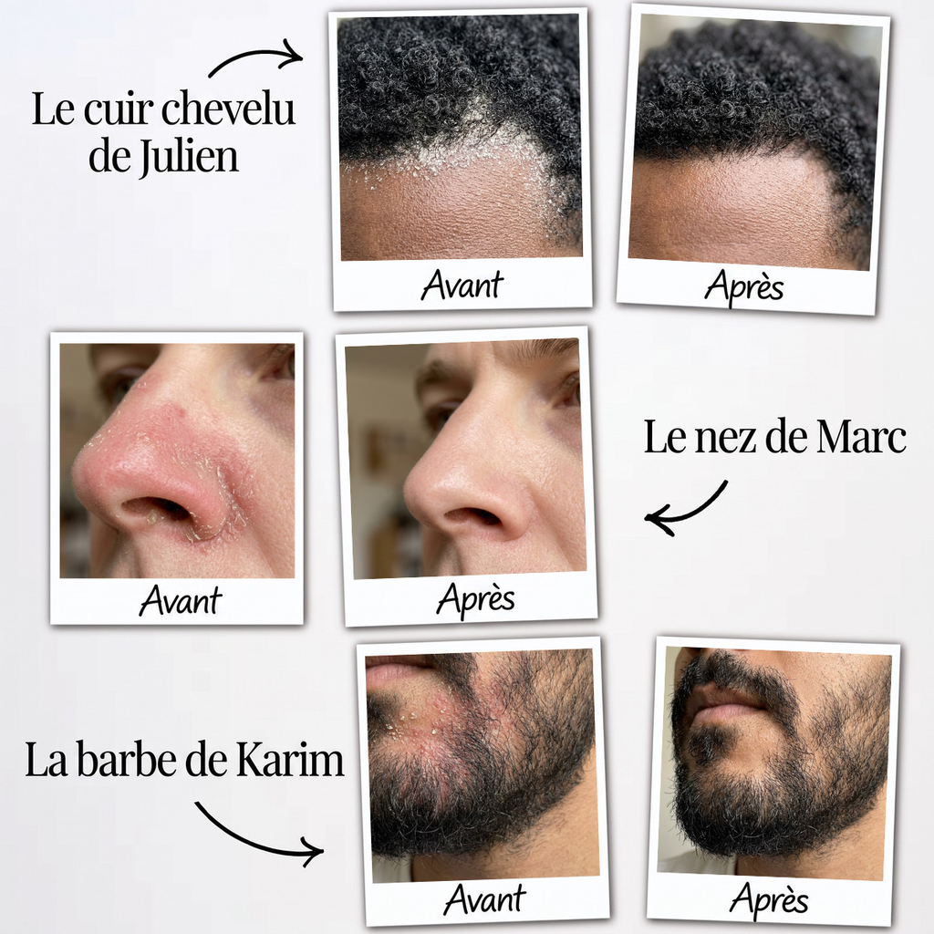 Malo Sérum Régulateur