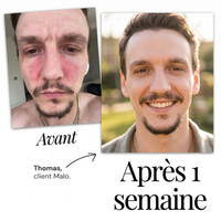 Malo Sérum Régulateur