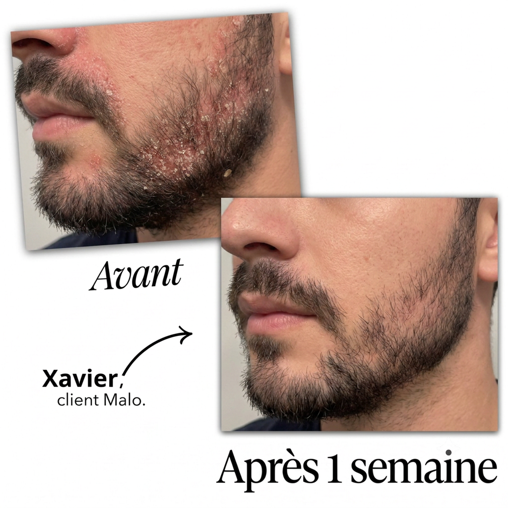 Malo Sérum Régulateur