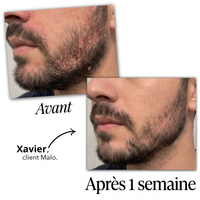 Malo Sérum Régulateur